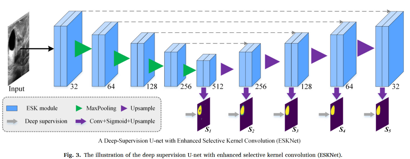 ESKNet：超声乳腺肿瘤分割的增强自适应选择核卷积