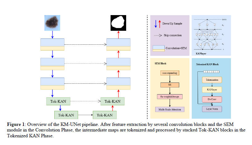 KAN-Mamba：首次讲Kan与Mamba融合的医学图像分割